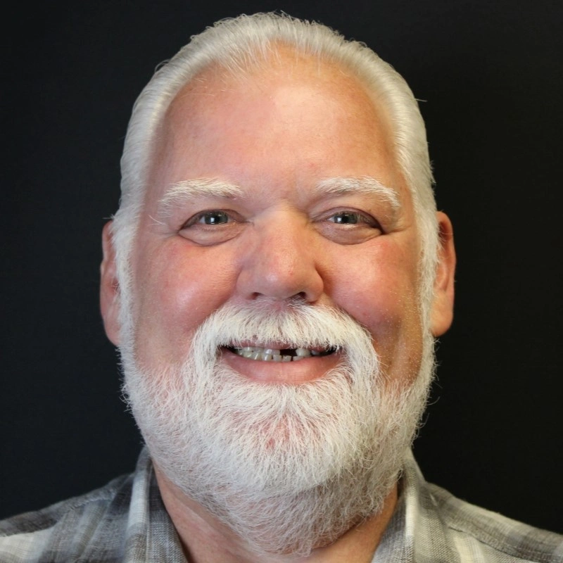 Steven before All-on-4 dental implants